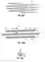 Fig. 24 - Apparatus and methods for implanting a replacement heart valve