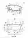 Fig. 02 - Mitral bileaflet valve