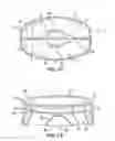 Fig. 04 - Mitral bileaflet valve
