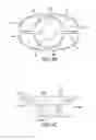 Fig. 07 - Mitral bileaflet valve