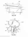 Fig. 08 - Mitral bileaflet valve