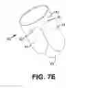 Fig. 08 - Implantable transcatheter intracardiac devices and methods for treating incompetent atrioventricular valves