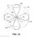 Fig. 15 - Implantable transcatheter intracardiac devices and methods for treating incompetent atrioventricular valves