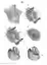 Fig. 04 - VALVE PROSTHESIS