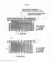 Fig. 07 - VALVE PROSTHESIS