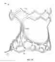 Fig. 04 - Collapsible prosthetic heart valves