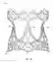 Fig. 05 - Collapsible prosthetic heart valves