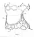 Fig. 06 - Collapsible prosthetic heart valves