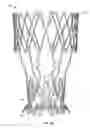 Fig. 30 - Collapsible prosthetic heart valves