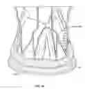 Fig. 42 - Collapsible prosthetic heart valves
