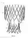 Fig. 48 - Collapsible prosthetic heart valves