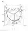 Fig. 52 - Collapsible prosthetic heart valves