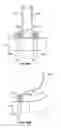 Fig. 61 - Collapsible prosthetic heart valves