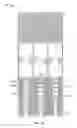 Fig. 62 - Collapsible prosthetic heart valves