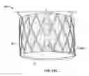 Fig. 66 - Collapsible prosthetic heart valves