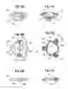 Fig. 07 - Methods of deploying a mitral heart valve