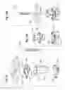 Fig. 08 - Methods of deploying a mitral heart valve