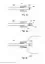 Fig. 04 - Prosthetic devices