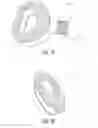 Fig. 16 - Spinal implant with fluid delivery capabilities
