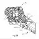 Fig. 16 - Expandable intervertebral implants and instruments