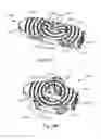 Fig. 19 - Expandable intervertebral implants and instruments