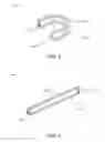 Fig. 04 - Shape-memory spinal fusion system