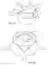 Fig. 08 - IN-SITU FORMED INTERVERTEBRAL FUSION DEVICE AND METHOD