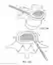 Fig. 11 - IN-SITU FORMED INTERVERTEBRAL FUSION DEVICE AND METHOD
