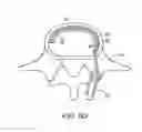 Fig. 17 - IN-SITU FORMED INTERVERTEBRAL FUSION DEVICE AND METHOD