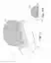 Fig. 03 - Mesh spacer hybrid