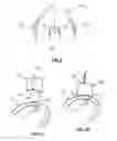 Fig. 10 - Devices, Systems, and Methods for Impacting Joint Implant Components