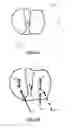 Fig. 12 - Devices, Systems, and Methods for Impacting Joint Implant Components