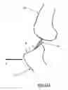 Fig. 13 - Devices, Systems, and Methods for Impacting Joint Implant Components