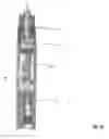 Fig. 15 - Electric motor driven tool for orthopedic impacting