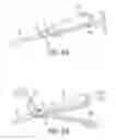 Fig. 07 - Methods and devices for removing a spinal disc