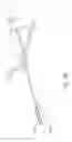 Fig. 19 - Methods and devices for removing a spinal disc