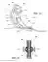 Fig. 12 - Pump mechanism