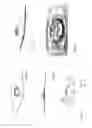 Fig. 14 - Adhesive support devices and methods of making and using them