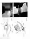 Fig. 34 - Adhesive support devices and methods of making and using them