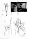 Fig. 54 - Adhesive support devices and methods of making and using them
