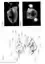 Fig. 55 - Adhesive support devices and methods of making and using them