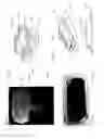 Fig. 64 - Adhesive support devices and methods of making and using them