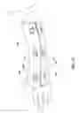 Fig. 13 - CLOSURE DEVICES AND METHODS FOR BIVALVED CASTS