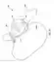 Fig. 18 - CLOSURE DEVICES AND METHODS FOR BIVALVED CASTS