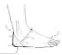 Fig. 01 - Heel Covering Device