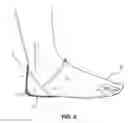 Fig. 03 - Heel Covering Device