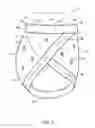 Fig. 04 - Absorbent article having interconnected waist and leg bands