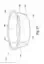 Fig. 18 - EXTREMITY SURGICAL SUPPORT DEBRIDEMENT PLATFORM