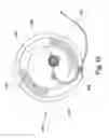 Fig. 20 - EXTREMITY SURGICAL SUPPORT DEBRIDEMENT PLATFORM