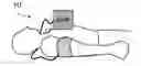Fig. 01 - Cardio pulmonary resuscitation quality feedback system